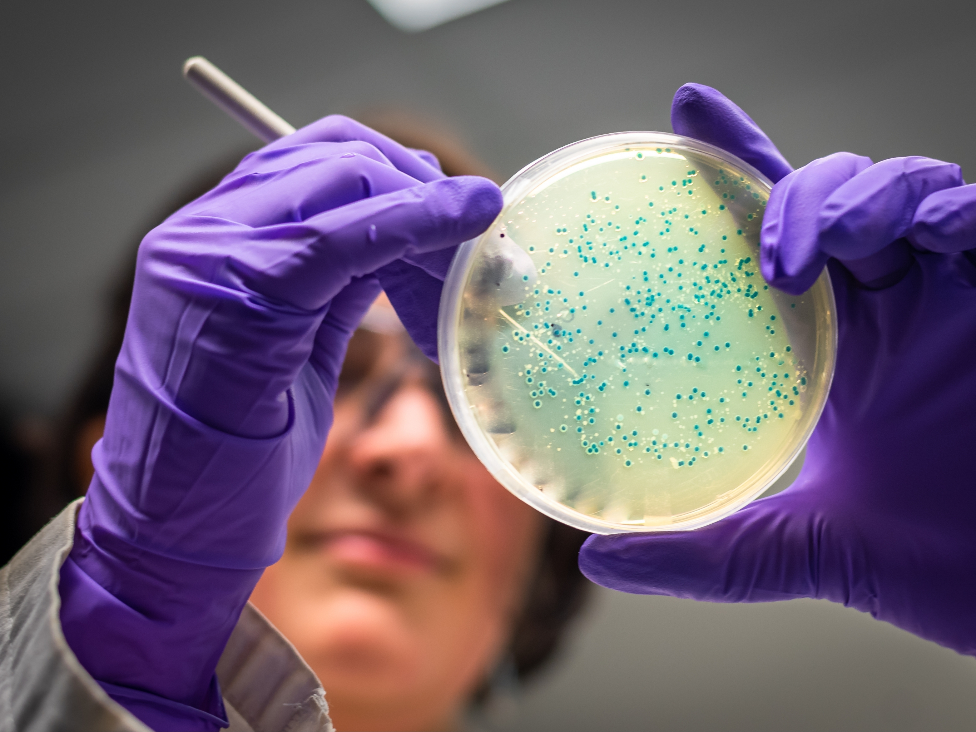 Kötü Anılar Artık Silinebilecek